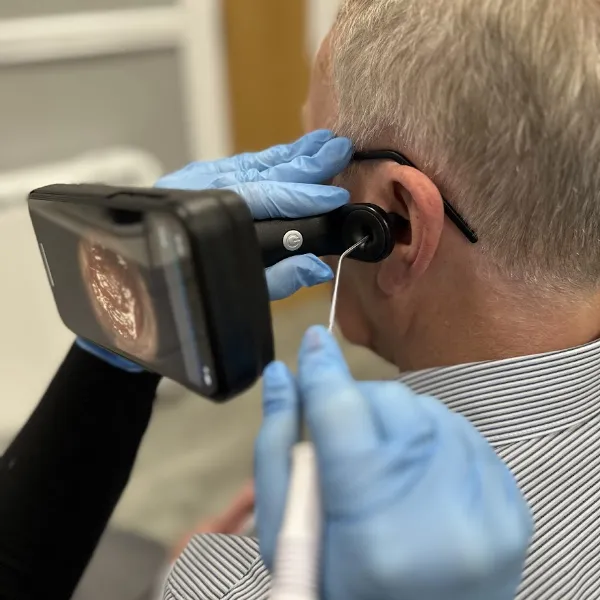 Microsuction Ear Wax Removal - That's Gentle & Effective